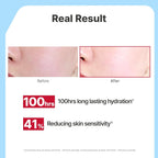 Illiyoon Ceramide Moisturizer for Dry & Sensitive Skin - 100hr Hydration, Vegan Certified