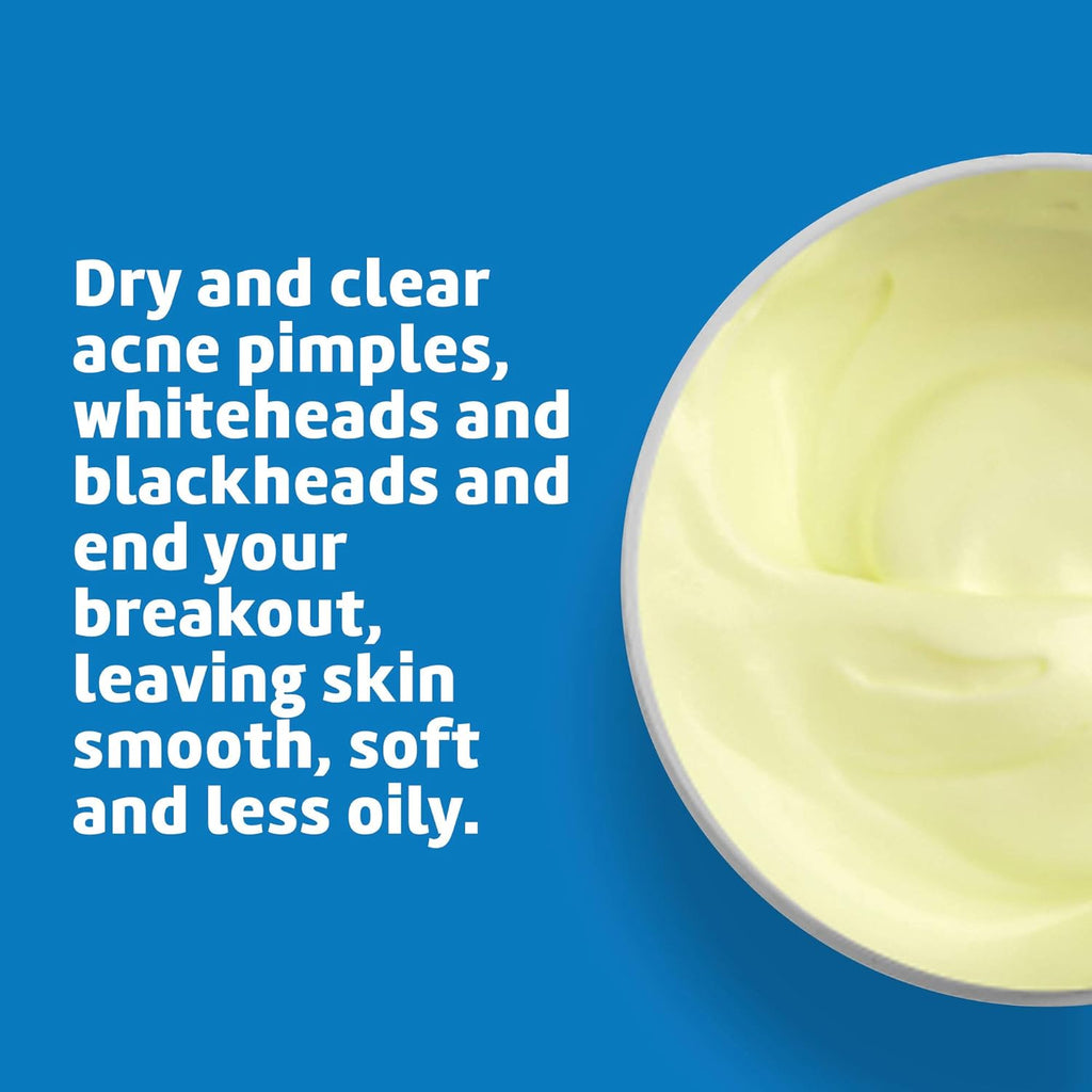 De La Cruz 10% Sulfur Ointment - Cystic Acne Treatment for Face & Body