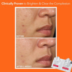 Dr. Dennis Gross Alpha Beta Extra Strength Daily Peel - 2-Step Exfoliating Pads for Smoother Skin & Radiance, 5 Treatments