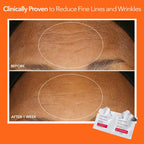 Dr. Dennis Gross Alpha Beta Extra Strength Daily Peel - 2-Step Exfoliating Pads for Smoother Skin & Radiance, 5 Treatments
