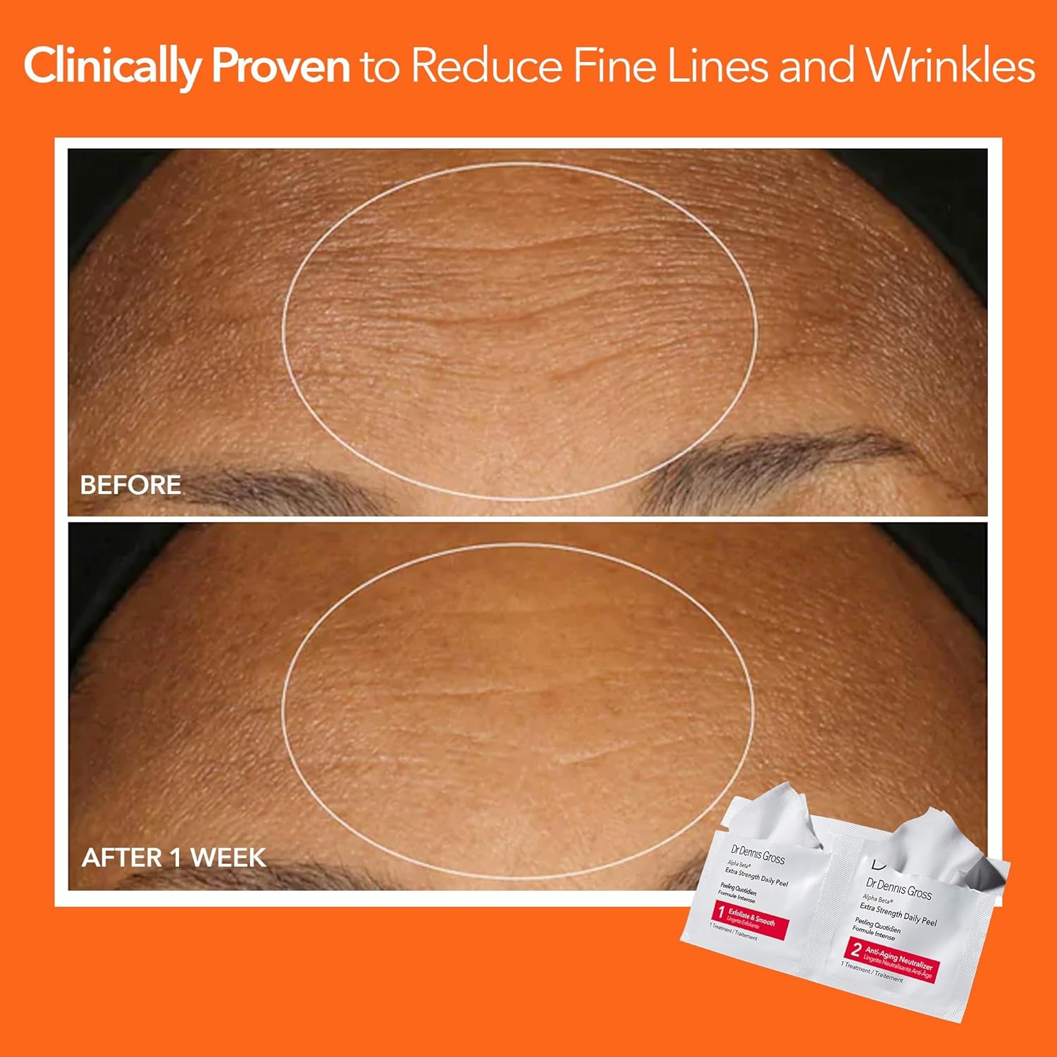 Dr. Dennis Gross Alpha Beta Extra Strength Daily Peel - 2-Step Exfoliating Pads for Smoother Skin & Radiance, 5 Treatments