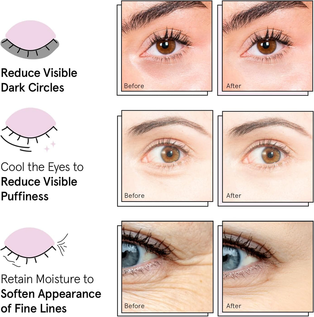 Grace & Stella Gold Under Eye Mask for Dark Circles & Puffiness - Vegan, 24 Pairs