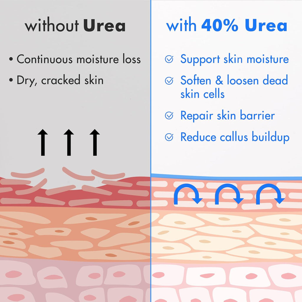 Ebanel 40% Urea Foot Cream with Salicylic Acid - For Dry Cracked Heels & Rough Skin, 4.6 oz Jar