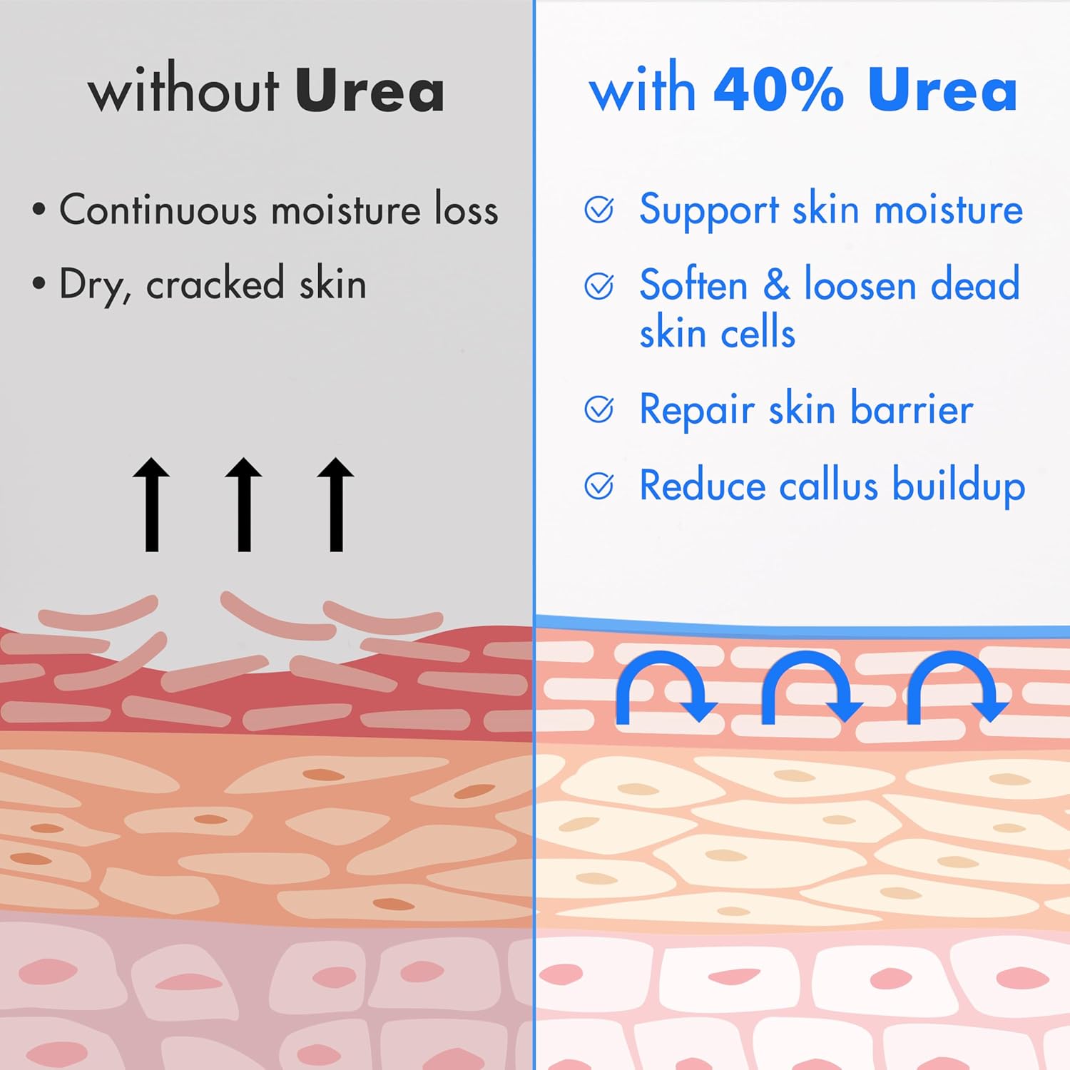 Ebanel 40% Urea Foot Cream with Salicylic Acid - For Dry Cracked Heels & Rough Skin, 4.6 oz Jar