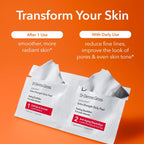 Dr. Dennis Gross Alpha Beta Extra Strength Daily Peel - 2-Step Exfoliating Pads for Smoother Skin & Radiance, 5 Treatments