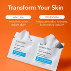 Dr. Dennis Gross Alpha Beta Ultra Gentle Daily Peel for Sensitive Skin - 5 Treatments