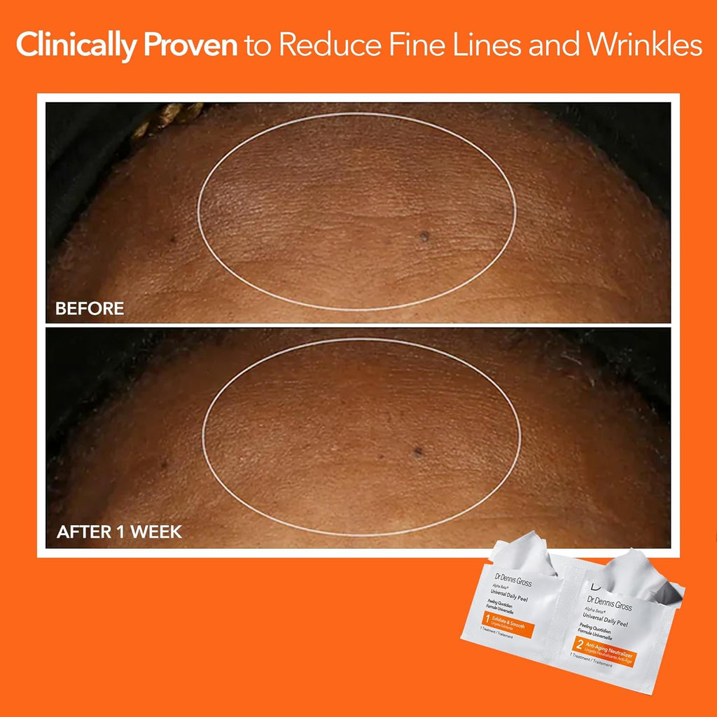 Dr Dennis Gross Alpha Beta Universal Daily Peel for Uneven Tone & Pores - 5 Treatments