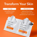 Dr Dennis Gross Alpha Beta Universal Daily Peel for Uneven Tone & Pores - 5 Treatments