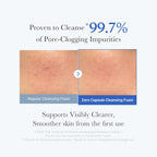 medicube Zero Pore Capsule Cleanser - Gentle Daily Foam for Blackheads & Smoother Skin, 4.23 oz