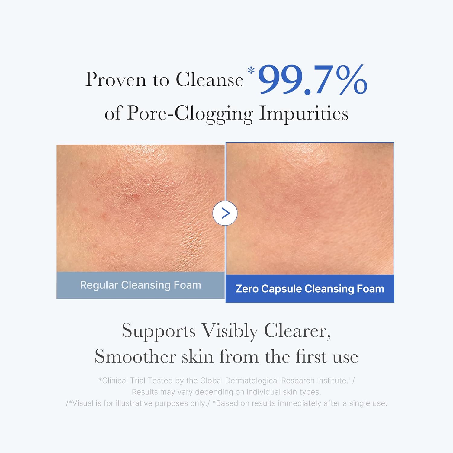medicube Zero Pore Capsule Cleanser - Gentle Daily Foam for Blackheads & Smoother Skin, 4.23 oz