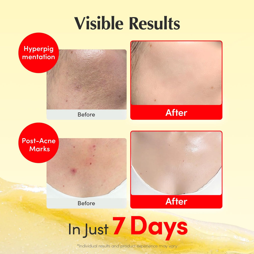 EQQUALBERRY Vitamin C & Niacinamide Cream for Dark Spots