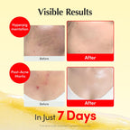 EQQUALBERRY Vitamin C & Niacinamide Cream for Dark Spots