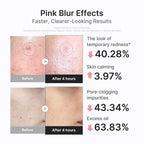 Medicube 3H Overnight Spot Drying Lotion for Troubled & Oily Skin - Calamine-Powered Formula, 20ml