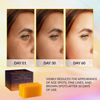 VALITIC Dark Spot Remover Soap Bars - Japanese Complex with Kojic Acid & Turmeric for Even Tone, 2 Pack