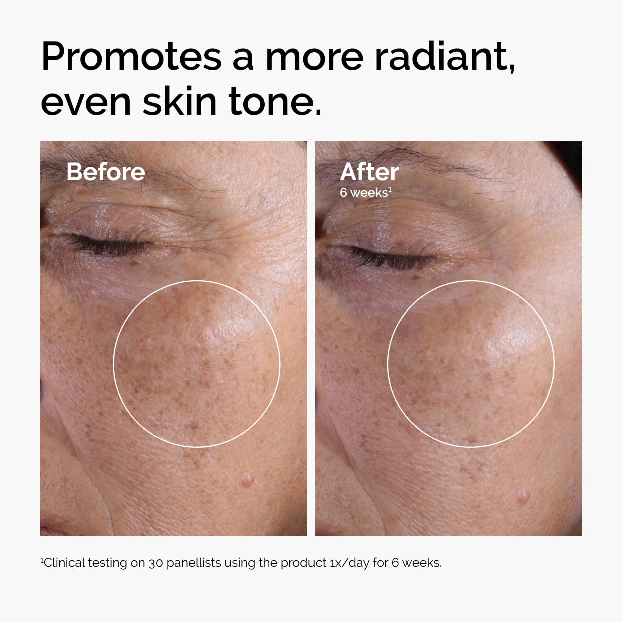 The Ordinary 7% Glycolic Acid Exfoliating Toner - Brightens & Evens Tone Daily