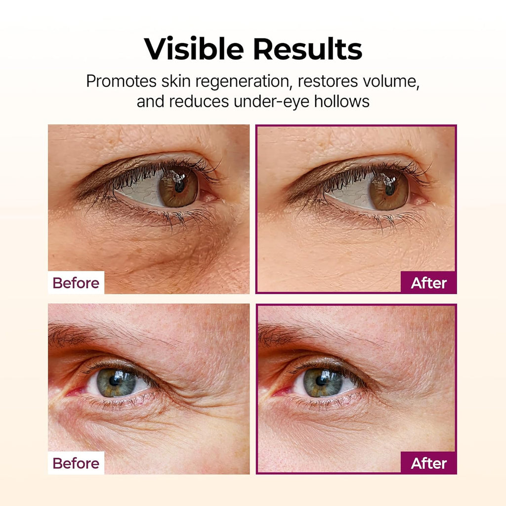 Dr.Melaxin Calcium Collagen Eye Balm Stick for Wrinkles & Dark Circles - Sensitive Skin Safe