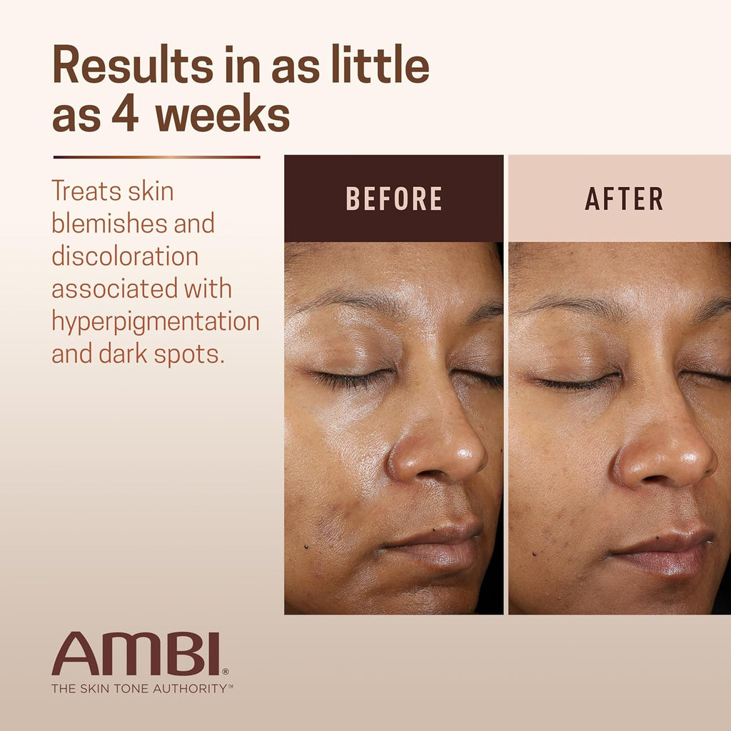 Hydroquinone-Free Dark Spot Corrector by Ambi Even & Clear - Fade Stubborn Spots in 2-3 Weeks