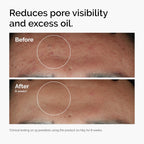 The Ordinary Niacinamide 10% + Zinc 1% Serum for Blemish-Prone Skin - Brightens & Smoothes in Weeks