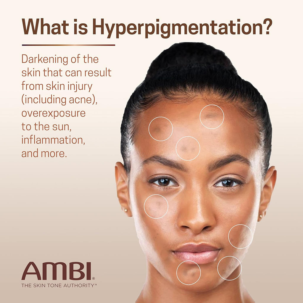 Hydroquinone-Free Dark Spot Corrector by Ambi Even & Clear - Fade Stubborn Spots in 2-3 Weeks